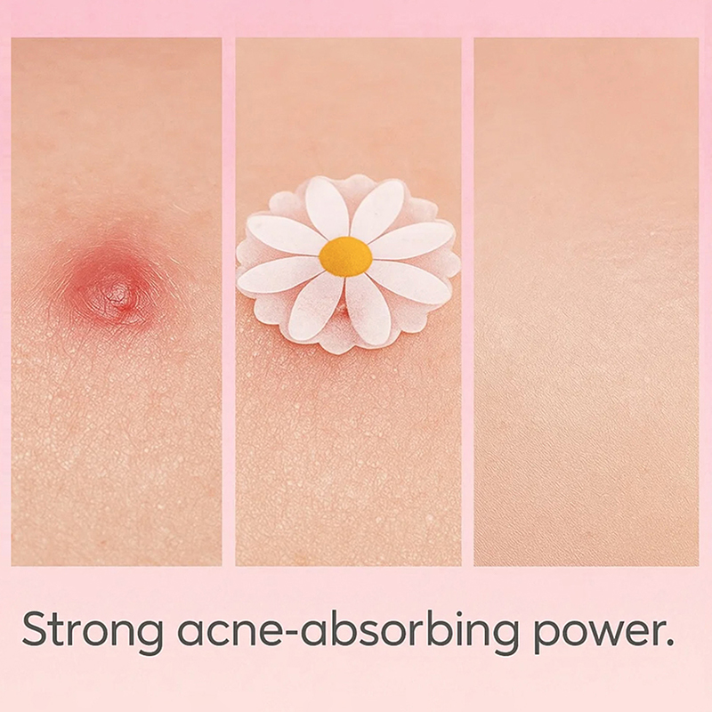 100個入り　フェイスケア用　ニキビパッチ　目立たないプロ仕 - Skincare China のレビューと価格